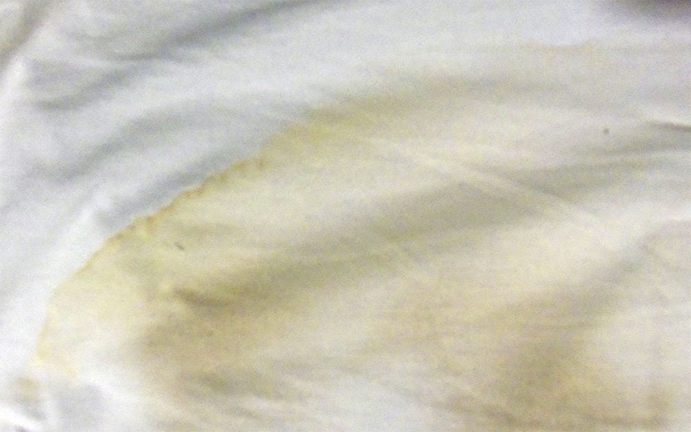 yellow stain on a white shirt